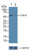 Cyclin Dependent Kinase 18 antibody, LS-C663476, Lifespan Biosciences, Western Blot image 