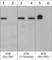 ATM Serine/Threonine Kinase antibody, AM3661, ECM Biosciences, Western Blot image 