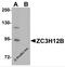 Zinc Finger CCCH-Type Containing 12B antibody, 5675, ProSci, Western Blot image 