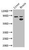 SMAD Specific E3 Ubiquitin Protein Ligase 1 antibody, CSB-PA875720LA01HU, Cusabio, Western Blot image 