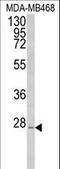 Peroxisomal membrane protein 11A antibody, LS-C163524, Lifespan Biosciences, Western Blot image 