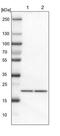 Transmembrane P24 Trafficking Protein 2 antibody, NBP1-80963, Novus Biologicals, Western Blot image 