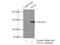 CD49c antibody, 21992-1-AP, Proteintech Group, Immunoprecipitation image 