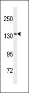 Ubiquitously Transcribed Tetratricopeptide Repeat Containing, Y-Linked antibody, 63-767, ProSci, Western Blot image 