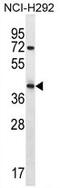 Arrestin Domain Containing 5 antibody, AP50260PU-N, Origene, Western Blot image 