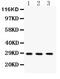 Dickkopf WNT Signaling Pathway Inhibitor 2 antibody, PB9551, Boster Biological Technology, Western Blot image 