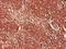 Proteasome Subunit Alpha 7 antibody, H00005688-M01, Novus Biologicals, Immunohistochemistry frozen image 