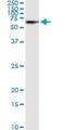 Serine/Threonine Kinase 33 antibody, H00065975-M02, Novus Biologicals, Immunoprecipitation image 