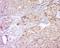 Signal Transducer And Activator Of Transcription 2 antibody, orb313243, Biorbyt, Immunohistochemistry paraffin image 