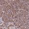 HPS3 Biogenesis Of Lysosomal Organelles Complex 2 Subunit 1 antibody, NBP1-92007, Novus Biologicals, Immunohistochemistry paraffin image 