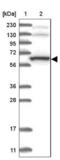 THUMP Domain Containing 3 antibody, NBP1-85132, Novus Biologicals, Western Blot image 