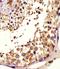 Trimethyllysine Hydroxylase, Epsilon antibody, orb373609, Biorbyt, Immunohistochemistry paraffin image 