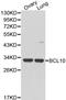 BCL10 Immune Signaling Adaptor antibody, LS-C192397, Lifespan Biosciences, Western Blot image 