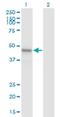 Armadillo Repeat Containing X-Linked 1 antibody, H00051309-M01, Novus Biologicals, Western Blot image 