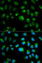 Toll-like receptor 1 antibody, STJ25862, St John