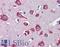 Cholinergic Receptor Nicotinic Alpha 7 Subunit antibody, LS-B3716, Lifespan Biosciences, Immunohistochemistry frozen image 