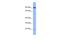 Zinc Finger Protein 780B antibody, A17712, Boster Biological Technology, Western Blot image 