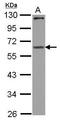 Cytoplasmic Polyadenylation Element Binding Protein 1 antibody, GTX123357, GeneTex, Western Blot image 