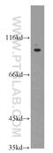 Transient Receptor Potential Cation Channel Subfamily V Member 4 antibody, 20987-1-AP, Proteintech Group, Western Blot image 