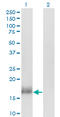 Calmodulin Like 3 antibody, LS-C104872, Lifespan Biosciences, Western Blot image 