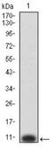 P2Y Receptor Family Member 8 antibody, NBP2-61765, Novus Biologicals, Western Blot image 