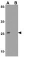 BMP And Activin Membrane Bound Inhibitor antibody, GTX31590, GeneTex, Western Blot image 