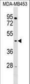 E3 ubiquitin-protein ligase RNF128 antibody, LS-C158863, Lifespan Biosciences, Western Blot image 