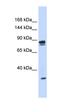 Pleckstrin And Sec7 Domain Containing 3 antibody, orb325011, Biorbyt, Western Blot image 
