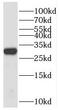 Ribonuclease A Family Member 11 (Inactive) antibody, FNab07325, FineTest, Western Blot image 