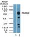 Preferentially Expressed Antigen In Melanoma antibody, PA5-23157, Invitrogen Antibodies, Western Blot image 