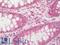 Isocitrate Dehydrogenase (NAD(+)) 3 Beta antibody, LS-C317365, Lifespan Biosciences, Immunohistochemistry paraffin image 
