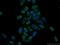 Eukaryotic Elongation Factor 2 Kinase antibody, 13510-1-AP, Proteintech Group, Immunofluorescence image 