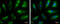 Fumarate Hydratase antibody, GTX630146, GeneTex, Immunofluorescence image 