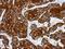 Keratin-17 antibody, NBP2-16089, Novus Biologicals, Immunohistochemistry frozen image 