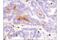 S100 Calcium Binding Protein A9 antibody, 34425S, Cell Signaling Technology, Immunohistochemistry frozen image 