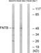 Farnesyltransferase, CAAX Box, Beta antibody, LS-C120256, Lifespan Biosciences, Western Blot image 