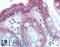 CHM Rab Escort Protein antibody, LS-B15524, Lifespan Biosciences, Immunohistochemistry paraffin image 