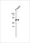 Solute Carrier Family 29 Member 1 (Augustine Blood Group) antibody, LS-C96639, Lifespan Biosciences, Western Blot image 