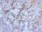 Mucin 16, Cell Surface Associated antibody, 33-838, ProSci, Immunohistochemistry paraffin image 