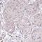 Zinc Finger Protein 417 antibody, HPA056213, Atlas Antibodies, Immunohistochemistry paraffin image 