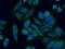 Polyribonucleotide Nucleotidyltransferase 1 antibody, 14487-1-AP, Proteintech Group, Immunofluorescence image 