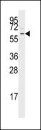 Transforming Growth Factor Beta Receptor 1 antibody, LS-C97221, Lifespan Biosciences, Western Blot image 