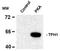 Tryptophan 5-hydroxylase 1 antibody, TA309263, Origene, Western Blot image 