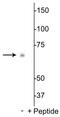 Ribosomal Protein S6 Kinase B1 antibody, P30407, Boster Biological Technology, Western Blot image 