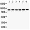 Inhibitor Of Nuclear Factor Kappa B Kinase Subunit Beta antibody, LS-C343915, Lifespan Biosciences, Western Blot image 