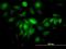 Ferritin Light Chain antibody, H00002512-M18, Novus Biologicals, Immunofluorescence image 
