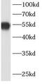 Programmed Cell Death 4 antibody, FNab06240, FineTest, Western Blot image 