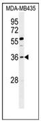 Forkhead Box E3 antibody, AP51707PU-N, Origene, Western Blot image 
