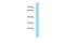 PAT1 Homolog 2 antibody, A15750, Boster Biological Technology, Western Blot image 