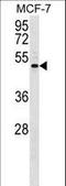 Ectonucleotide Pyrophosphatase/Phosphodiesterase Family Member 5 antibody, LS-C159533, Lifespan Biosciences, Western Blot image 